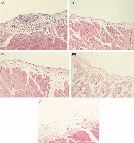 Figure 2. H&E staining of representative samples of peritoneal tissues. (A) In UFF-C group, there was thickening of the submesothelial area with inflammatory cell infiltration and neoangiogenesis. (B) Control rat peritoneum. (C) In the MSC-IP group, there was submesothelial thickness similar compared to C group. (D) In the MSC-IV group, morphological changes did not significantly differ in from C group. (E) In the P group, increased submesothelial thickness and peritoneal fibrosis with neovascularization was seen (×10).