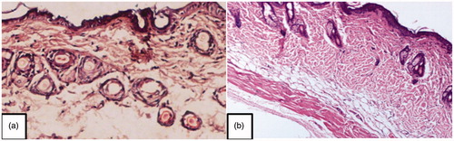 Figure 5. Histopathological photographs showing absence of any histological and pathological changes (a) Control untreated skin (b) skin treated with Formulation VI (magnification, ×100). (The readers are referred to the web version of the article).