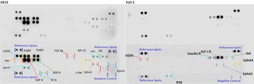 Figure 1 Detection of phospho-tyrosine growth factor receptors using a dot blot array. Phospho-tyrosine dot blot analyses of esophageal cancer cell lines OE33 and FLO-1. The lower portion of each panel is annotated showing what each positive spot represents. Note each blot has 3 internal reference spots that provide a comparator for comparing blots. The upper panel is the identical blot to the lower panel, without annotation.