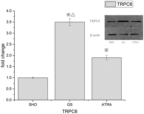 Figure 4. Evaluation of protein expression of TRPC6 (Western-blot). ※ p < .05 compared with the SHO group, △ p < .05 compared with the ATRA group.