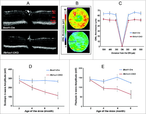 Figure 11. RPE degeneration leads to retinal degeneration. Loss of autophagy function in the RPE resulted in a secondary loss of photoreceptors. (A) The retinal thinning was due to reduction in the ONL as seen on cross section OCT imaging of 8-moold mice, and (B) the automated ONL thickness measurement shown as a heat map. (C) Manual measurement of the ONL thickness vs. total retinal thickness confirmed the automated measurements. (C, D) There was decreased scotopic and photopic electroretinography responses, consistent with the loss of photoreceptors.