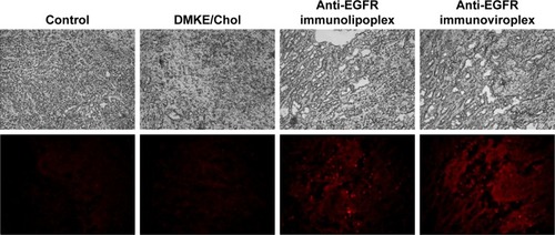 Figure 5 In vivo localization of anti-EGFR immunonanoparticles in tumors.Notes: Rhodamine-labeled anti-EGFR immunonanoparticles were intravenously administered to mice carrying SK-OV-3 tumors. In all, 24 hours post injection, tumor tissues were dissected and then examined using a fluorescence microscope (×100).Abbreviations: EGFR, epidermal growth factor receptor; DMKE, O,O′-dimyristyl-N-lysyl glutamate; Chol, cholesterol.