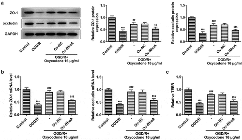 Figure 6. Oxycodone alleviated the permeability damage in OGD/R-induced brain microvascular endothelial cells through RhoA/ROCK/MLC2 signal. The expressions of ZO-1 and occludin were measured using Western blot (a) and RT-qPCR (b). (c) The relative TEER was detected using TEER analysis. ***P < 0.05 vs. control; ##P < 0.01 and ###P < 0.001 vs. OGD/R; $$P < 0.01 and $$$P < 0.001 vs. Ov-NC.