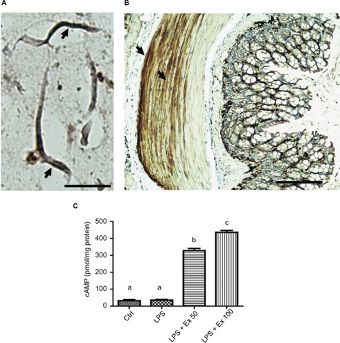 Figure 6 Expression of GLP-1 receptor on mouse CSMCs. (A) Micrograph depicting immunohistochemical staining of GLP-1R in mouse isolated single CSMCs, scale bar=40 μM. Arrows show cytoplasmic and membranous staining indicative of GLP-1R expression. (B) Micrograph depicting immunohistochemical staining of GLP-1R in mouse mid-colon section, scale bar=100 μM. Arrows show GLP-1R staining in colon muscularis layer, indicating expression of GLP-1R in CSMCs. (C) cAMP levels in CSMCs treated with: control (Ctrl), LPS, LPS+exendin-4 (50 nM), and LPS+exendin-4 (100 nM) for 10 min. Different lowercase letters indicate significant statistical difference between groups where p<0.05.Abbreviations: cAMP, cyclic adenosine monophosphate; CSMC, colon smooth muscle cell; Ex 50, exendin-4 (50 nM); Ex 100, exendin-4 (100 nM); LPS, lipopolysaccharide.