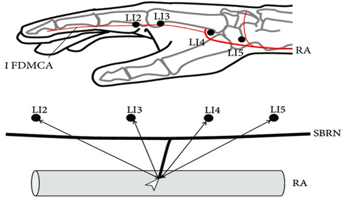 Figure 4 Diagrams of anatomical measurements. Schematic of acupuncture points Hegu in the LI4; R.A, radial artery.Citation127