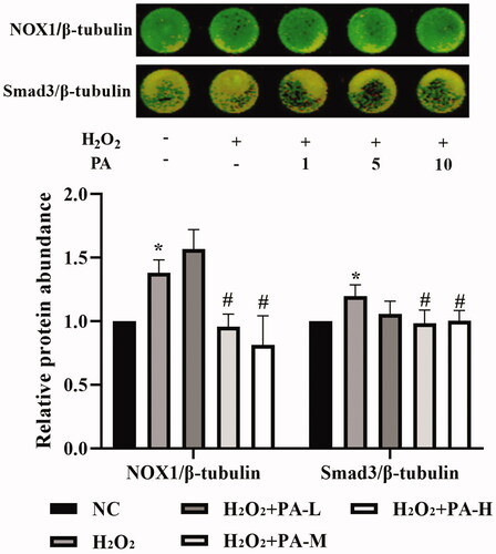 Figure 12. Effects of phenylacetamide on NOX1 and Smad3 in H9c2 cells. The colour in the circle represents the composite colour of the corresponding target protein (red) and β-tubulin (green). The value of the NC group was set at 1, and the relative value was presented as fold induction to that of the NC group. Values are expressed as the mean ± SD of 6 samples. *p < 0.05, **p < 0.01 vs. NC group; #p < 0.05, ##p < 0.01 vs. H2O2 group.