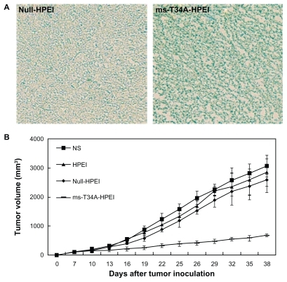 Figure 3 Antitumor effect of ms-T34A-HPEI on subcutaneous C-26 tumor models in vivo. (A) Transfection ability of HPEI was evaluated in vivo, while Lac-Z gene was used as the report gene. Blue staining means the gene expression, and (B) tumor volume of each treatment group. Mice bearing C-26 tumors were treated with NS, HPEI, null-HPEI, or ms-T34A-HPEI every three days for five doses (5 μg DNA/dosage).Note: There was a significant difference in tumor volume between ms-T34A-HPEI and the controls (P < 0.05).Abbreviations: HPEI, heparin-polyethyleneimine; ms-T34A, mouse survivin-T34A; NS, normal saline.