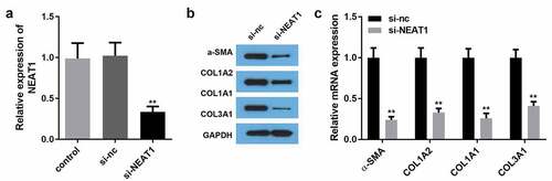 Figure 2. NEAT1 knockdown inhibited the production of ECM proteins