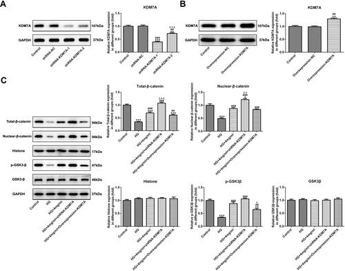 Figure 4 Catalpol regulates the Wnt/β-catenin signaling pathway through KDM7A in MC3T3-E1 cells induced by HG. (A, B) The transfection effects of KDM7A was verified by Western blot analysis (n=3). **P<0.01 and ***P<0.001 vs. control group. ##P<0.01 and ###P<0.001 vs. shRNA-NC group. ##P<0.01 vs. overexpression-NC group. ∆∆∆P<0.001 vs. shRNA-KDM7A-1 group. (C) The expression of Wnt/β-catenin signaling pathway in HG-induced MC3T3-E1 cells after transfection was detected by Western blot analysis (n=3). *P<0.05, **P<0.01 and ***P<0.001 vs. control group. ##P<0.01 and ###P<0.001 vs. HG group. ∆P<0.05, ∆∆P<0.01 and ∆∆∆P<0.001 vs. HG+4mg/mL group.