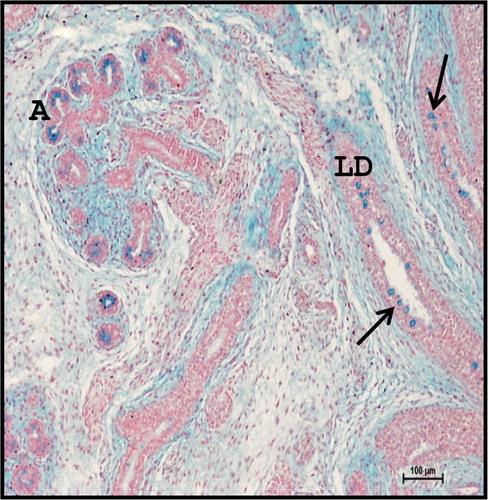 Figure 5. Photomicrograph of mandibular salivary gland of 21.2 cm CVRL (122nd day) buffalo foetus showing acinar cells (A) and large excretory ducts (LD) with goblet cells (arrows) were moderate to strong positive for acidic mucopolysaccharides. Alcian Blue 2.5 method ×100.