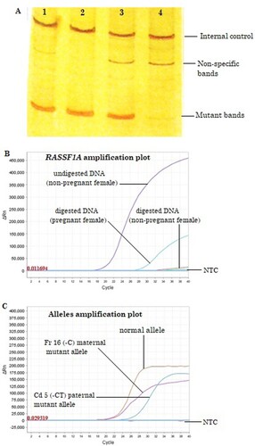 Figure 1. Results interpretation of fetal inheritance of paternally inherited mutation (Cd 5 (-CT)) pattern. (a) Cellular DNA (fetal, father, and mother) analysis by conventional ARMS-PCR: Mutant bands on lanes 1 and 2 represent paternal inherited mutation in fetal samples; lane 3 shows the same paternal allele; and lane 4 shows negative for the paternal mutation. (b) RASSF1A gene amplification plot of RT-PCR using cell-free DNA from maternal plasma: Amplification curves indicate the confirmation of cf-DNA in undigested DNA of nonpregnant plasma sample and cff-DNA in digested DNA plasma sample of pregnant women, while no amplification curve appeared in DNA digests of nonpregnant women plasma sample. NTC, not template control. (c) Identification of fetal inheritance using cf-DNA by ARMS RT-PCR using allele-specific primers: amplification curves show the identification of maternal normal and mutant alleles and paternal inherited mutant allele in maternal plasma.