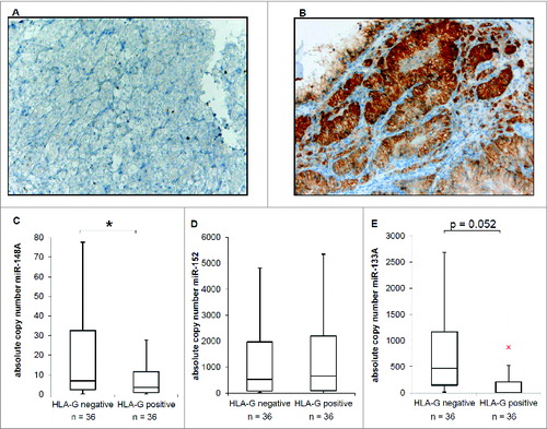 Figure 3. Inverse correlation of HLA-G and HLA-G relevant miR expression in RCC tumor lesions. (A) Representative immunohistochemical staining for a HLA-G− RCC lesion (sample II5, WHO grade: G2). (B) Representative immunohistochemical staining for a HLA-G+ RCC lesion (sample II39, WHO grade: G2). (C, D, E) Quantification of the expression of miR-148A (C), miR-152 (D) and miR-133A (E) by qPCR in 36 HLAG− and 36 HLA-G+ RCC lesions (listed in Table 1), respectively. The absolute copy number determination is visualized as Box–Whisker plot. Statistical analyses were performed as described in Materials and Methods.
