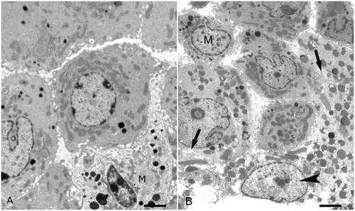 Figure 2. Ultrastructure of interstitial spaces. (A) Control mouse. Several Leydig cells and one testicular macrophage (M) are shown; scale bar: 1.3 µm. (B) Alcohol treated mouse. Several Leydig cells and one testicular macrophage (M) are shown. Two Leydig cell show rarefaction of the cytoplasm (arrows). One Leydig is degenerated (arrowhead). Leukocytes are not present; scale bar: 1.3 µm.