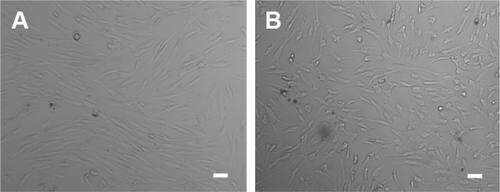 Figure S3 Cell morphology of BM-MSCs co-cultured with T-platelets for 0 hours (A) and 24 hours (B).