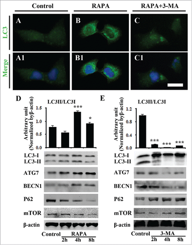 Figure 6. The exposure of RAPA promotes LC3 expression in cultured HUVECs. (A-C) The LC3 immunofluorescent staining was performed on 8-h exposed HUVECs with 0.1% DMSO (control) (A), RAPA (B) and RAPA+3-MA. A1-C1: DAPI staining + A-C respectively. (D) Western blot data showing the expressions of LC3-I/LC3-II, Atg7, Beclin-1, mTOR, P62 and β-actin at 2-h, 4-h and 8-h incubation following the treatments of RAPA. (E) Western blot data showing the expressions of LC3-I/LC3-II, Atg7, Beclin-1, mTOR, P62 and β-actin at 2-h, 4-h and 8-h incubation following the treatments of 3-MA. Abbreviation: HUVECs, human umbilical vein endothelial cells. Scale bars = 20 µm in A-C, A1-C1.