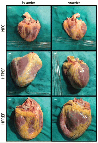 Figure 2. Epicardial adipose tissue in human hearts. Representative anterior and posterior views of human explanted hearts as a non-failing control (NFC) (weight = 290 g), heart failure with preserved ejection fraction (HFPEF) (ejection fraction = 55%; weight = 590 g) and heart failure with reduced ejection fraction (HFREF) (ejection fraction = 23%; weight = 678 g) depicting the extensive epicardial adipose tissue. Scalebar indicates 1 cm.