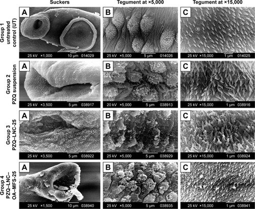Figure 3 SEM images of male worms recovered from the hepatic and mesenteric veins of mice of the four study groups.Notes: SEM of a male Schistosoma mansoni worm recovered from infected untreated mice (Group 1) showing (A) normal OS and VS (×1,000), (B) dorsal tegument surface with uniform size, regularly distributed T, and visible S (×5,000), and (C) apically situated S (×15,000); infected PZQ suspension-treated mice (Group 2) showing (A) distorted OS (×3,500), (B) flattening of some T with loss of S (×5,000), and (C) distorted S (×15,000); infected PZQ–LNC-25-treated mice (Group 3) showing (A) distorted OS (×3,500), (B) severe tegumental damage with erosion of the surface and appearance of subtegumental tissue (×5,000), and (C) distorted S (×15,000); and infected PZQ–OA–MFS–LNC-25-treated mice (Group 4) showing (A) distorted OS (×1,500), (B) severe tegumental damage with erosion of the surface and appearance of subtegumental tissue (×5,000), and (C) distorted S (×15,000).Abbreviations: LNC, lipid nanocapsules; MFS, miltefosine; OA, oleic acid; OS, oral sucker; PZQ, praziquantel; S, spines; SEM, scanning electron microscopy; T, tubercles; VS, ventral sucker.