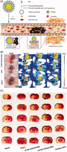 Figure 5. A sequential site-specific delivery of thrombolytics and neuroprotectant for ischemic stroke. (A) Schematic design of targeted delivery of tP-NP-rtPA/ZL006e. A core − shell structured nanocarrier was constructed where the platelet membranes were cloaking the surface of ZL006e-loaded acetal-modified dextran (m-dextran) polymer nanoparticles, and rtPA was decorated on the platelet membranes via click chemistry reaction. To achieve the stimuli-triggered rtPA release and ZL006e BBB-enhanced penetration, a thrombin-cleavable peptide with a sequence of LTPRGWRLGGC26 coupled with Tat cell-penetrating peptide, was introduced as a linker to obtain the tP-NP-rtPA/ZL006e. (B) In vivo targeted thromblysis was validated by the bloodstream recovery of common carotid artery, damaged by 10% FeCl3 for 10 min after injected with tP-NP-rtPA/ZL006e, rtPA, and saline. (C) Indication of neuroprotective efficacy by TTC-stained brain sections of the MCAO model group, sham-operated group, tP-NP-rtPA/ZL006e group, nP-NP-rtPA/ZL006e group, and free ZL006e + rtPA group. The nonischemic area is observed as red, and the infarct area is shown in white. Adapted with permission from Ref. (Xu et al., Citation2019). Copyright 2019 American Chemical Society.