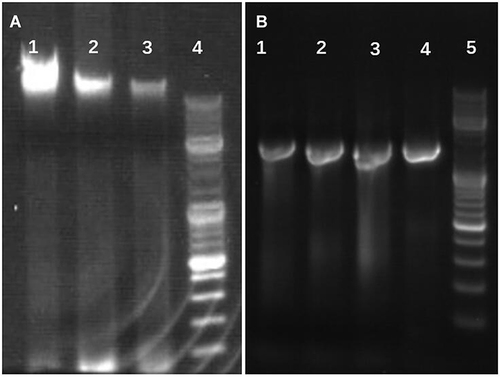 Figure 2 The results of genomic extraction and 16sRNA electrophoresis of three isolates. (A) The results of genomic extraction from three isolates. Lane 1: S18010071_S, Lane 2:R17123922_R, Lane 3:R18013231_R, Lane 4: DNA Marker 10,000. (B) The electrophoretic results of the products amplified by 16srDNA universal primers. Lane 1:S18010071_S; Lane 2:R17123922_R; Lanes 3 and 4: R18013231_R, Lane 5: DNA Marker 10,000.