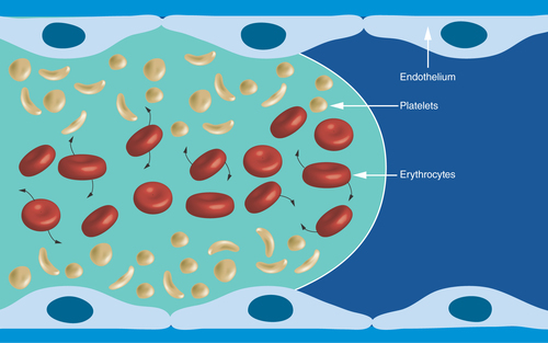 Figure 4.  Distribution of platelets and erythrocytes in arterial flowing laminar blood.The rotating and deforming erythrocytes increase the concentration of platelets at the vessel wall.