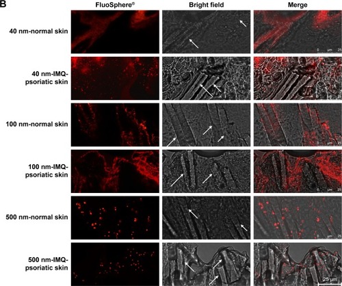 Figure 4 CLSM visualization of vertical sections from normal and imiquimod-induced psoriatic skins, which were treated with 40-, 100-, and 500-nm-sized FluoSpheres® for 24 hours at 32°C.Notes: Two views were given to present the wide structure of skin penetration (A, 200×), as well as the enlarged field of the distribution around hair follicles (B, 1,260×). For picture A, bar =100 µm, while for picture B, bar =25 µm. The emission wavelength was between 590 and 656 nm for 40 and 100-nm-sized FluoSphere® when the excitation wavelength was set as 552 nm, while the emission wavelength was between 495 and 545 nm for 500-nm-sized FluoSphere® when the excitation wavelength was set as 488 nm. The white arrows indicate the hair follicles.Abbreviations: CLSM, confocal laser scanning microscopy; IMQ, imiquimod.