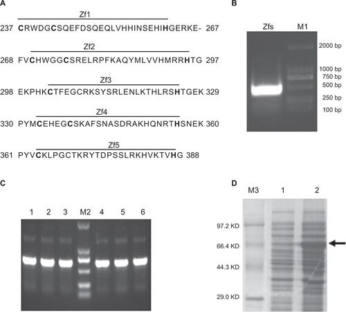 Figure S1 Gli1 zinc finger peptide synthesis.Notes: (A) The amino acid sequence of the five zinc finger motifs of the Gli1 protein. The “–” symbol indicates a gap. (B) Restriction enzyme analysis of the recombinant plasmid pMAL-C2X-Gli1-Zf by EcoRI and HindIII. Lane M1, Dl-2000 DNA marker; lane 1, products of the recombinant pMAL-C2X-Gli1-Zf plasmid digested with EcoRI and HindIII. (C) Polymerase chain reaction analysis of the cloned strains. Lane M2, DL-2000 DNA marker, lanes 1–6, products of the six clones. (D) SDS-PAGE: Lane M3, TaKaRa protein marker (broad); lane 1, uninduced cell pellet; lane 2, induced cell pellet containing the Gli1 zinc finger motifs as indicated by the arrow.Abbreviations: Zfs, zinc finger motifs; SDS-PAGE, sodium dodecyl sulfate polyacrylamide gel electrophoresis; Bp, base pair; KD, kilo-Dalton.