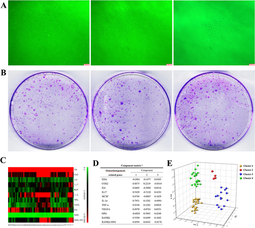 Figure 2 Clustering analysis of the colony forming units (CFUs) of fibroblasts. (A) The fibroblast aggregations of colony formation units (CFUs) from healthy controls, gingivitis patients and periodontitis patients (original magnification of ×40x, scale bar = 200 μm). (B) CFUs formed from 1000 cells isolated from the three groups. (C) Thermogram indicating the different expression of genes in each CFU. (D) Factor loading of the assessed osteoclastogenesis-related genes in PC1, PC2 and PC3. (E) Each pellet with a number represents the median position of its corresponding CFU in the PC1, PC2, and PC3 coordinate system, in which CFUs were divided into four clusters (yellow pellet, CFUs of Cluster 1; red pellet, CFUs of Cluster 2; blue pellet, CFUs of Cluster 3; and green pellet, CFUs of Cluster 4).