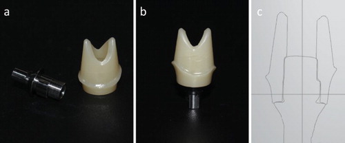 Figure 5. Two-piece zirconia abutment for titanium implants. (a) The two components of the two-piece zirconia abutment: the metallic titanium base and the zirconia superstructure. (b) The two components were glued together as a unit, which is then connected to the titanium implant with a central screw. (c) Computer-aided design of a customised two-piece zirconia abutment.