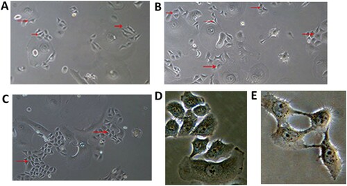 Figure 3. Cell recrudescence after irradiation.Note: Optical microscope, ×100. A, B, and C were taken 7, 10, and 14 d after radiation was ceased, respectively. The red arrow indicates new cells or clones. D, E Optical microscope, ×400. D, Two weeks after radiation was ceased, cells propagated by fission, as in giant, abnormal, multinucleated cells. E, Mitosis telophase in a tumor cell with normal morphology 2 weeks after radiation was ceased.