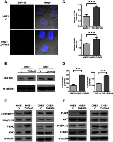 Figure 2 Effects of ZNF488 on adhesion ability and FAK signaling pathway. (A) Immunofluoresce for ZNF488 detection. (B) Western blot to detect ZNF488 protein level in both HNE1 and CNE1 ZNF488 overexpression stable cell lines and vector. (C) Adhesion assay in HNE1 and CNE1. (D) FAK activation assay to detect the activity of pFAK (Y397). (E) Western blot to detect collagen IV, integrin α5, FAK and p-FAK(Y397). (F) Western blot to detect ERK 1/2, p-ERK1/2, Akt and p-Akt. *** P<0.001.