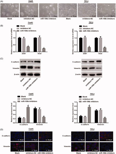 Figure 6. Down-regulation of miR-106b on EMT biomarkers in CasKi and HeLa cells. (A) cell morphology of CasKi and HeLa cells under an inverted microscope (×100); (B) qRT-PCR showed decreased mRNA expressions of ZEB1 and Snail in miR-106b inhibitors group; (C) Western blotting showed cells in miR-106b inhibitors group had elevated expression of E-cadherin, and decreased expression of vimentin; (D) Immunofluorescence showed E-cadherin overexpressed in miR-106b inhibitors group and vimentin reduced in miR-106b inhibitors group; *compared with blank group, p <.05