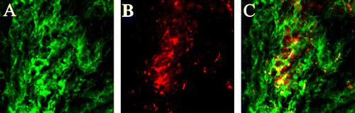 Figure 2.  Expression of α-smooth muscle actin in human adipose-derived stem cells (ADSCs) at 8 weeks after transplantation. Representative fluorescent staining for α-smooth muscle actin (A, green), human ADSCs stained with DiI (B, red) and superimposed images are shown here (C). Original magnification:×100.