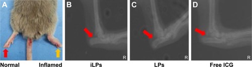 Figure 3 RA model and radiological evalution. (A) RA models were successfully induced by injection with collagen and Freund’s adjuvant. (B, C, and D) Radiological evaluation showed there was no joint destruction and interarticular stenosis in inflamed paw in mice pretreated with iLPs, LPs, and free ICG. The yellow arrow indicates the normal paw, and the red arrow indicate the inflamed paw.Abbreviations: iLPs, ICG-liposomes decorated with iRGD; LPs, ICG-liposomes; ICG, indocyanine green; RA, rheumatoid arthritis; iRGD, targeting peptide (CRGDKGPDC).
