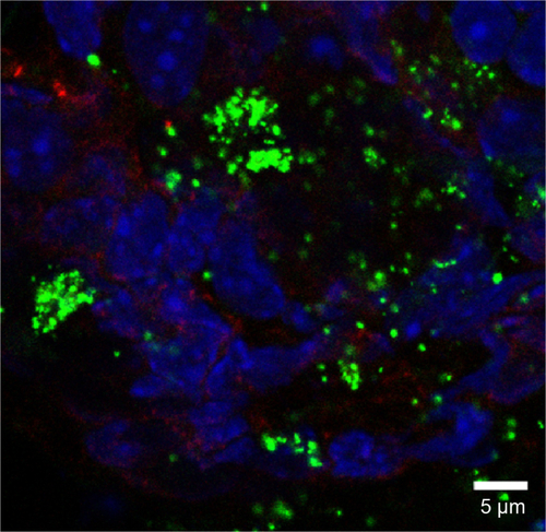 Figure S8 Rhodamine 6G/silica particles in cecum tissue.Notes: Mice were administered optimized Rhodamine 6G/silica particles orally every 24 hours for 4 days, and organs were harvested 3 hours after the final administration. Confocal microscopy of frozen cecum tissue section is shown. Section was stained with 4′,6′-diamidino-2-phenylindole (cell nuclei; blue) and E-cadherin (junctions between epithelial cells; red). Rhodamine 6G/silica particles are green.