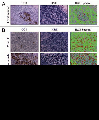 Figure 3 Characterization of an apoptosis-specific spectral signature in H&E-stained tumor sections. (A) Serial HCT15 tumor sections from mice treated with lexatumumab (10mg/kg; 24 h) were immunostained for CC8 or H&E, in the absence of chromagenic staining for an apoptotic marker. Spectral analysis using the PARISS was then performed on the H&E-stained section. Images are shown are 20X-magnified. (B) Serial sections from HCT15 tumors were stained and analyzed as in (A), with the exception that 40X magnification was employed. Images are shown for CC8 immunostaining, H&E staining and HS I pseudo-maps for control and lexatumumab treatments. (C) Spectral data from (B) are represented in histograms comparing individual spectra for control and lexatumumab treatment groups. Statistical significance was determined by Student's t-test.