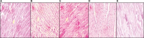 Figure 6 Histopathological section of myocardium.