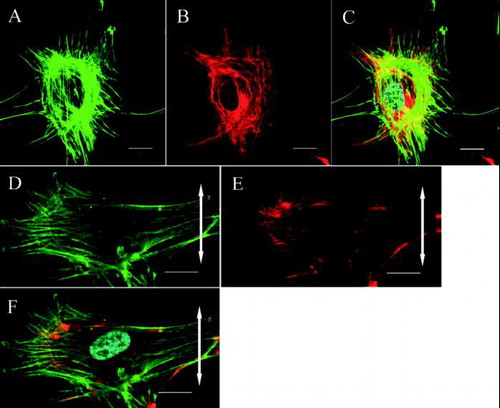 FIG. 2 Confocal laser scanning microscopy. The cytoskeletal organization of a ligament fibroblast in the control group (A, B, C) and the stretched group (D, E, F) (Bar: 20 μm). The double-headed arrows represent the direction of applied stretching. In the control group, the actin stress fibers (A: green) and vimentin meshwork (B: red) are distributed randomly. (C) Merged image (nucleus: cyan). After stretching, the actin stress fibers (D: green) and vimentin meshwork (E: red) are oriented parallel to the longitudinal axes of the cells. (F) Merged image.