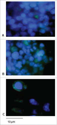 Figure 4. Expression of the L21–200 proteins in HEK-293 cells upon transfection. Immunofluorescence in cells transfected with L21–200 (A), ss- L21–200 (B) and ss-L21–200-E7* (C) constructs. FITC fluorescence was coupled with DAPI nuclei blue counter-staining (original magnification, 100x; scale bar, 10 µm).