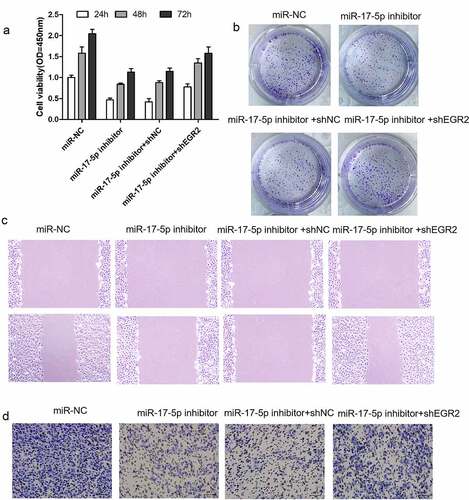 Figure 4. Downregulation of EGR2 reverses anti-tumor roles of miR-17-5p inhibition in TC cells