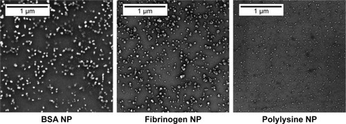 Figure 5 SEM images of NP from BSA, fibrinogen, polylysine 15–30 kDa.Abbreviations: SEM, scanning electronic microscopy; NP, nanoparticles; BSA, bovine serum albumin.