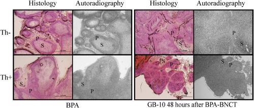 Figure 2. Light microscopy images of cryostat sections (30 μm) of tumor stained with hematoxylin-eosin and the corresponding neutron autoradiography images (10×). P = parenchyma, S = stroma.