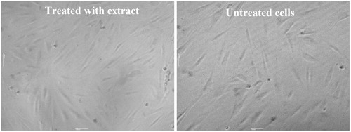 Figure 2. Morphology of primary human skin fibroblasts, untreated cells or treated with 50 μg/mL extract for 72 h at magnification of 10×.