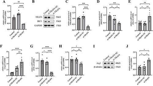 Figure 7 IRF5 may be a down-stream effector of TRAF6 in M2 macrophage polarization. (A) TRAF6 mRNA expression level in BMDMs after si-TRAF6 or corresponding NC transfection (n=4). (B–D) Representative western blot image (B) and quantification of the protein expression level of TRAF6 (C) (n=4) and IRF5 (D) (n=6) in BMDM after transfected with si-TRAF6 or corresponding NC. (E and F) mRNA expression of M2 markers (Mrc1 and Arg1) in BMDM (n=6). (G and H) mRNA expression of M1 markers (IL-1β and TNF-α) in BMDM (n=5–6). (I and J) Representative western blot image (I) and quantification of protein expression levels of Arg1 (J) in BMDM (n=4). All data are presented as mean ± SEM. Statistical analysis was performed with one-way ANOVA followed by Tukey’s test. *P<0.05, **P<0.01, ***P<0.001, ****P<0.0001.