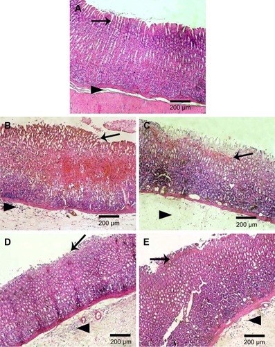 Figure 7 Histological examination (HE, 100×) of rats stomach.Notes: (A) Normal control showing normal gastric mucosa (arrow) and submucosa (arrow head), (B) positive control with coagulative necrosis of entire mucosal thickness with intense hemorrhage and desquamation of necrotic glandular epithelium (arrow) as well as congestion of blood vessels, severe edema, and neutrophilic infiltrations in the submucosa (arrow head), (C) orally pretreated with naringin (100 mg/kg) showing coagulative necrosis of luminal half of the gastric mucosa with hemorrhage and desquamation of necrotic glandular epithelium (arrow) as well as severe edema (arrow head) and neutrophilic infiltrations in the submucosa, and orally pretreated with either (D) naringin (200 mg/kg) or (E) naringin–PF68 micelles (100 mg/kg) displaying coagulative necrosis of only superficial layer of gastric mucosa (arrow) and mild desquamation of necrotic glandular epithelium, besides mild edema and neutrophilic infiltrations in the submucosa (arrow head).Abbreviations: HE, hematoxylin and eosin; PF68, pluronic F68.