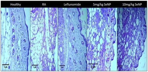 Figure 10 A comparative histological analysis of paw tissues from the treated and untreated groups of mice. Bone erosion and distorted cellular morphology are visible in arthritic mice (RA), whereas selenium nanoparticles treated groups display somewhat restored cellular morphology.Abbreviations: RA, rheumatoid arthritis; SeNP, selenium nanoparticles.