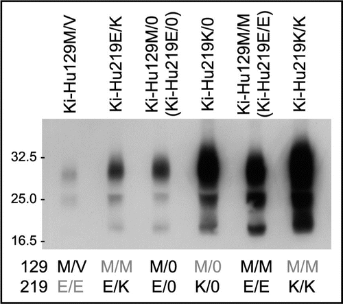 Figure 1 Heterozygous inhibition in vCJD infection. Western blot analysis of PrPSc in the spleens of knock-in mice intraperitoneally inoculated with vCJD prions. The amount of PrPSc in the 129M/V heterozygous mice was even lower than that in the 129M/0 hemizygous mice. Furthermore, the amount of PrPSc was the highest in the 219K/K mice, whereas the PrPSc accumulation in the 219E/K heterozygous mice was even lower than that in the 219E/0 hemizygous mice or 219K/0 hemizygous mice. Therefore, we found that both the conversion incompetent PrP and the conversion competent PrP showed inhibitory effects in the heterozygous animals.