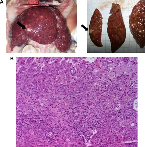 Figure 3 (A) Macroscopic appearance of dyschromic, whitish tumor (black arrows) developed on cirrhotic liver in rats given DEN for 9 weeks and which died after exploratory laparotomy at week 12. (B) Representative H&E section of HCC in rats that died after laparotomy, showing a trabecular pattern with nuclear atypia and absence of portal tract (low magnification, ×10).