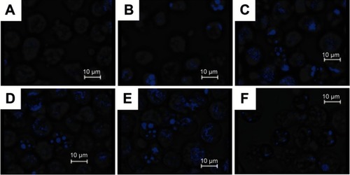 Figure 2 Morphological analysis of nuclear chromatin condensation after exposure of HL60 cells to fullerene derivatives. Cells were treated with fullerene derivatives and were stained with Hoechst 33342 (167 μM) ((A) Control, (B) 1 (32.5 μM), (C) 10 (5.0 μM), (D) 13 (5.0 μM), (E) cis-14 (5.0 μM), (F) Doxorubicin (0.50 μM)).