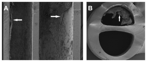 Figure 3 SEM of (A) longitudinal and (B) lateral cuts performed on the CVC.