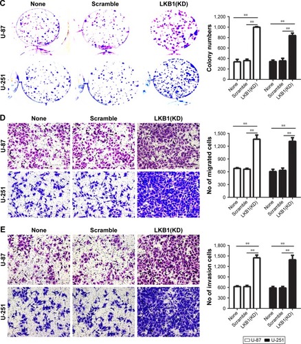 Figure 2 Downregulation of LKB1 promotes glioma cell proliferation, migration, and invasion.Notes: (A) The knockdown efficiency against LKB1 was verified by Western blot in U-87 and U-251 cells. (B) Growth curves between none, scramble, and LKB1(KD) by CCK-8 assay. The results are shown as the mean ± SD of at least three independent experiments. (C–E) Representative images (left panels) and histogram quantification (right panels) of the (C) colony formation assay, (D) Transwell migration, and (E) invasion assays with U-87 and U-251 cells. Statistical significance was assessed using one-way ANOVA followed by Dunnett’s tests for multiple comparisons. Scale bars: 50 µm. **P<0.01 and ***P<0.001.Abbreviations: CCK-8, Cell Counting Kit-8; LKB1, liver kinase B1; KD, knockdown.